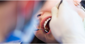 Endodontic treatment - Root canal