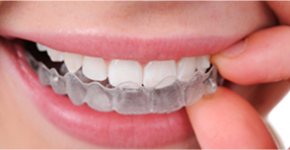 Gum disease / Laser gum dentistry
